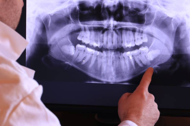 Best Orthodontic Emergency Dentist in Bloomfield, IA