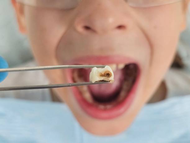 Best Orthodontic Emergency Dentist in Bloomfield, IA