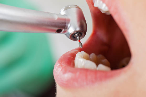 Best Mobile Emergency Dentist in Bloomfield, IA